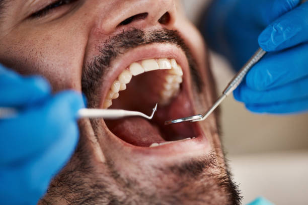 Best Emergency Dental Services for Seniors in Abilene, KS